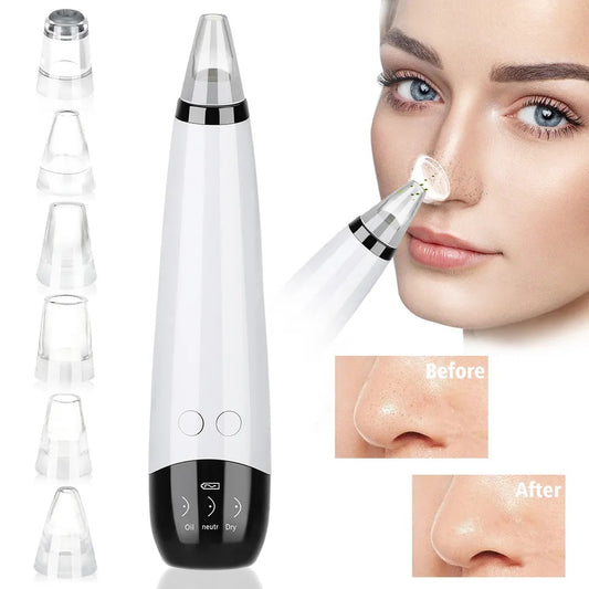 6 In 1 Blackhead Removal Machine Led Display - Rechargeable Blackhead Vacuum  - Acne Suction Face Cleaner